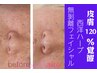 最近人気の【ハーブトリートメント】はクロエクロウでは10年目の定番メニュー