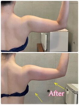 エクセレントビューティーサロン 艶(EN)/ブライダル１回