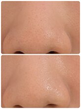 プライベートサロン 美月/