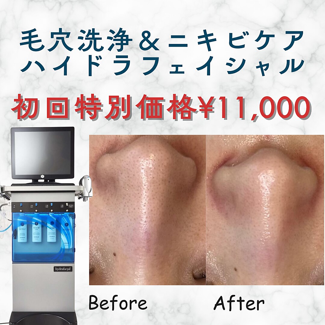 美シェリ(美Cheri)｜ホットペッパービューティー