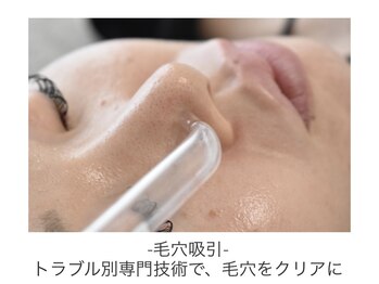 ステラ(Stella)/毛穴吸引