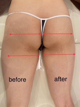 Beauty Salon Leyra【バストアップ/痩身/小顔/筋膜リリース】【4/22 NEWOPEN(予定)】/