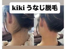 キキ(kiki)/うなじ脱毛