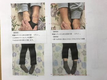 経絡整体院中村の写真/体の歪は骨盤から、背骨迄歪みます、骨盤矯正、胸椎強瀬だけでは効果なし
