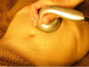 サロンドボーテ イグレック(Salon de beaute Y)/人気のキャビテーションもご用意