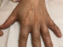 ネイルサロンアンドスクール シーグリーン(SEAGREEN)/【お悩み事例】お肌の乾燥