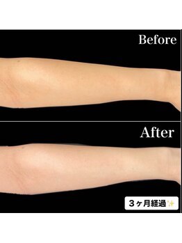 リブ(Lib)/White shine