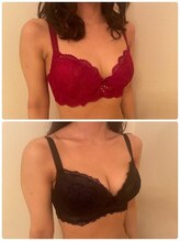 美人バスト 辻堂店/◇バストアップ/症例◇