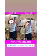 ヒデ整体院(Hide整体院)/猫背矯正骨盤矯正B/A肩こり腰痛