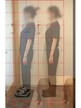 ホリスティックボディ ライカ(Lycka)/美容矯正