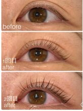 プティカラン(Petite Calin)/※マイラミネーション公式引用