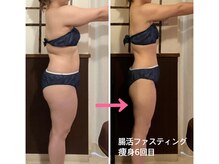 リアン(Liens)/痩身6回と腸活エステ