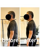 熊本カワル整体 JR上熊本駅院/猫背