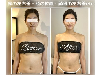 蒼(so)/全身[調律]小顔矯正でお顔を短く