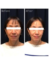 たくろう鍼灸院 豊田本院/Before&After