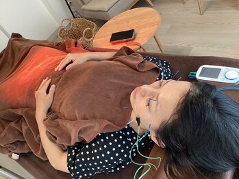 ハリファ鍼灸院 横浜関内院(HariFa鍼灸院)/美容施術