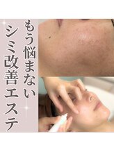 エステティック エイチアンドビー 大和店(H&B)/シミケア　フェイシャル