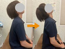 首の痛みも、一度でこれだけ動くようになります。