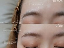 シエナ アイ(CIENA eye)/