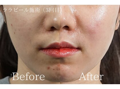 美肌育成サロン Soelの写真