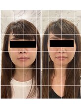 Beauty Salon Leyra【バストアップ/痩身/小顔/筋膜リリース】【4/22 NEWOPEN(予定)】/