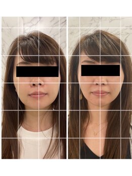 Beauty Salon Leyra【バストアップ/痩身/小顔/筋膜リリース】【4/22 NEWOPEN(予定)】/