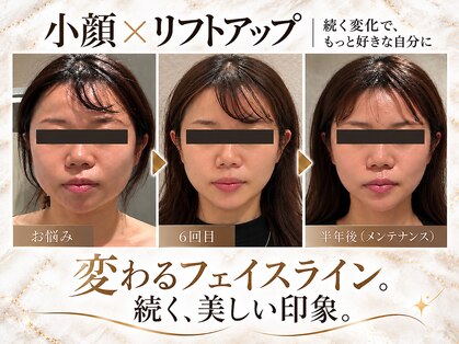 ラブミー 渋谷本店(LoveMe)の写真