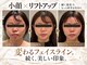 ラブミー 渋谷本店(LoveMe)の写真