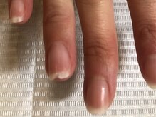 ネイルサロンアンドスクール シーグリーン(SEAGREEN)/【お悩み事例】　爪が欠ける