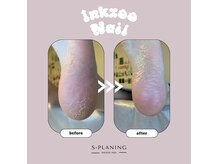 インクズーネイル(INKZOO NAIL)の雰囲気（韓国式角質ケアで赤ちゃんの様なふわふわの足裏へ！）