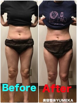 美容整体ユメカ(美容整体YUMEKA)/骨盤ダイエット+骨盤ストレッチ