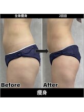 Sスタイルスタジオ 福岡天神/全身そう身2回目のお客様