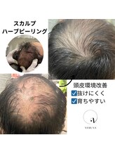リノ(Lino)/育毛の促進！土台整えるスカルプ