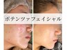 肌質改善×ニキビケア◎ポテンツァフェイシャル　¥29,800→¥16,500