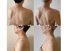 ガチガチ首肩、肩甲骨得意です◎70歳初回お手入れ前→15回目(後)