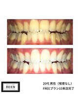 レオン 磐田(REON)/◇ お客様 before＆after ◇