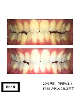 レオン 磐田(REON)/◇ お客様 before＆after ◇