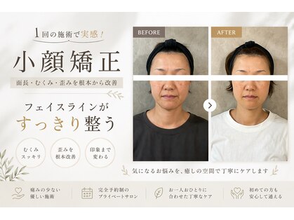 スリー(three)の写真