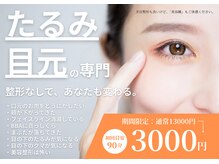 シルエラバレ(CiruelaValle)