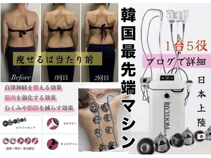 プラスベル(plus Belle)の写真