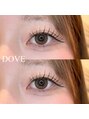ドーヴ(DOVE)&nbsp;フラットラッシュ100本