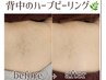 《ボディハーブピーリング》剥けないハーブピーリング¥19500