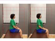 摂津本山駅前鍼灸整骨院/ビフォーアフターになります！