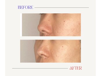 はりと美容鍼灸治療院(HaRi&美容鍼灸治療院)/