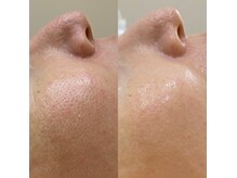 シャルル ストア 京都三条通(Chaleureux Store)の雰囲気（やり過ぎ毛穴開きになっていませんか？表面刺激は肌を硬くします）