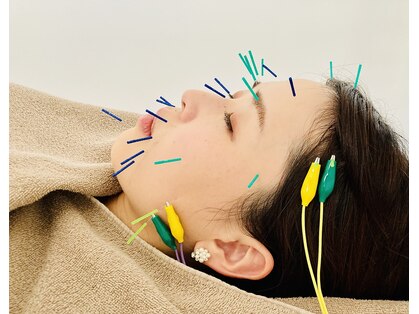 熊本鍼灸小雀斎の写真