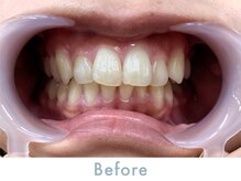 PARTIE BEAUTY 天満店【ネイル/ホワイトニング】