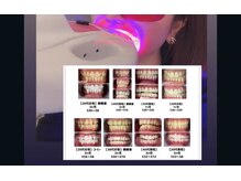 シャルム(CHARME)/セルフホワイトニング