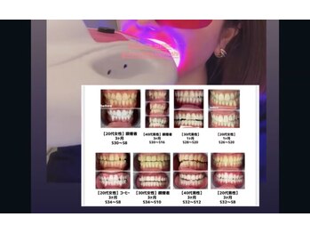 シャルム(CHARME)/セルフホワイトニング