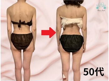 パラアモール(Paraamor)/猫背→運動なしでヒップアップ